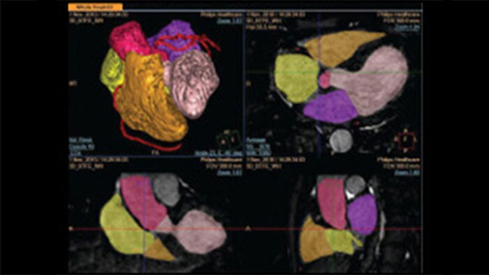Cardiology Informatics