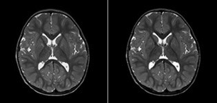 clinical case image