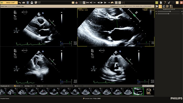 Ultrasound workflows