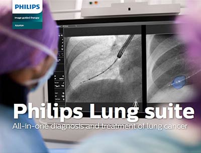 Philips Lung suite pdf
