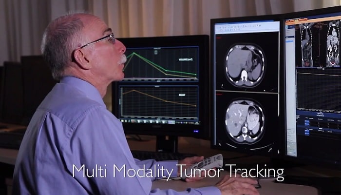 Multi-Modality Tumor Tracking on IntelliSpace Portal at Sheba Medical -Center, Tel Ha -Shomer, Israel