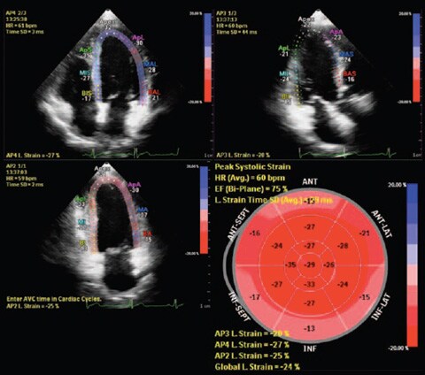 aius feature scanning