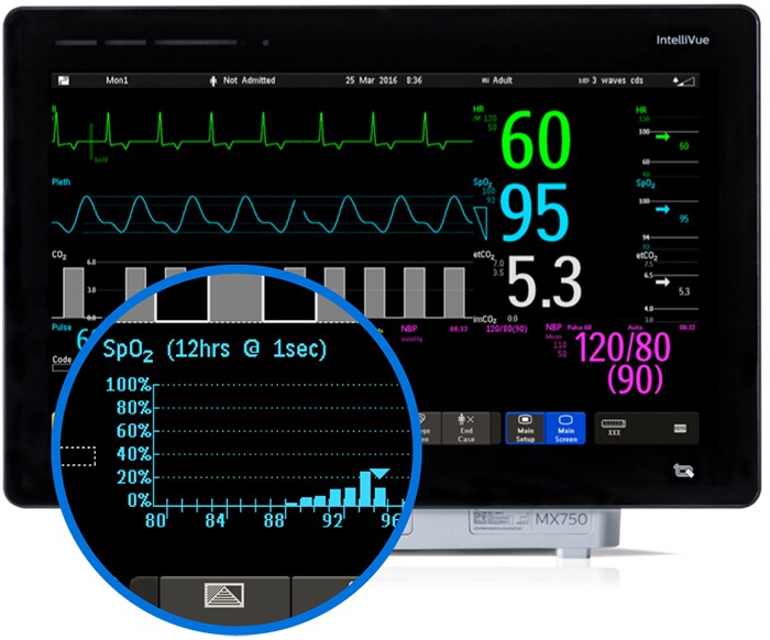 Monitoring the histogram and patients response desktop