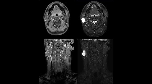 clinical case image